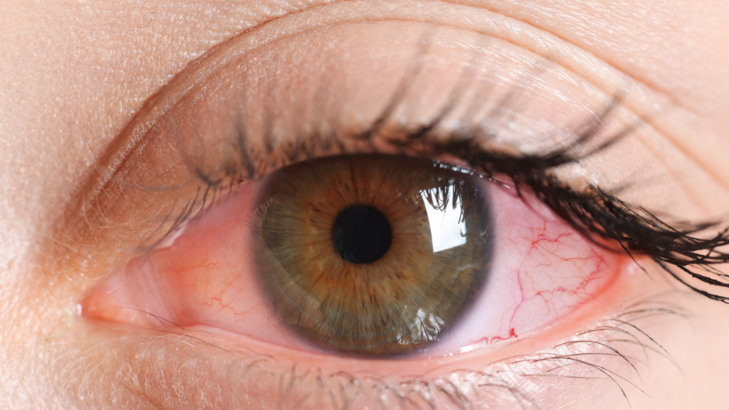 Warning signs of eye problems checked at Eye Hospital in Kharar
